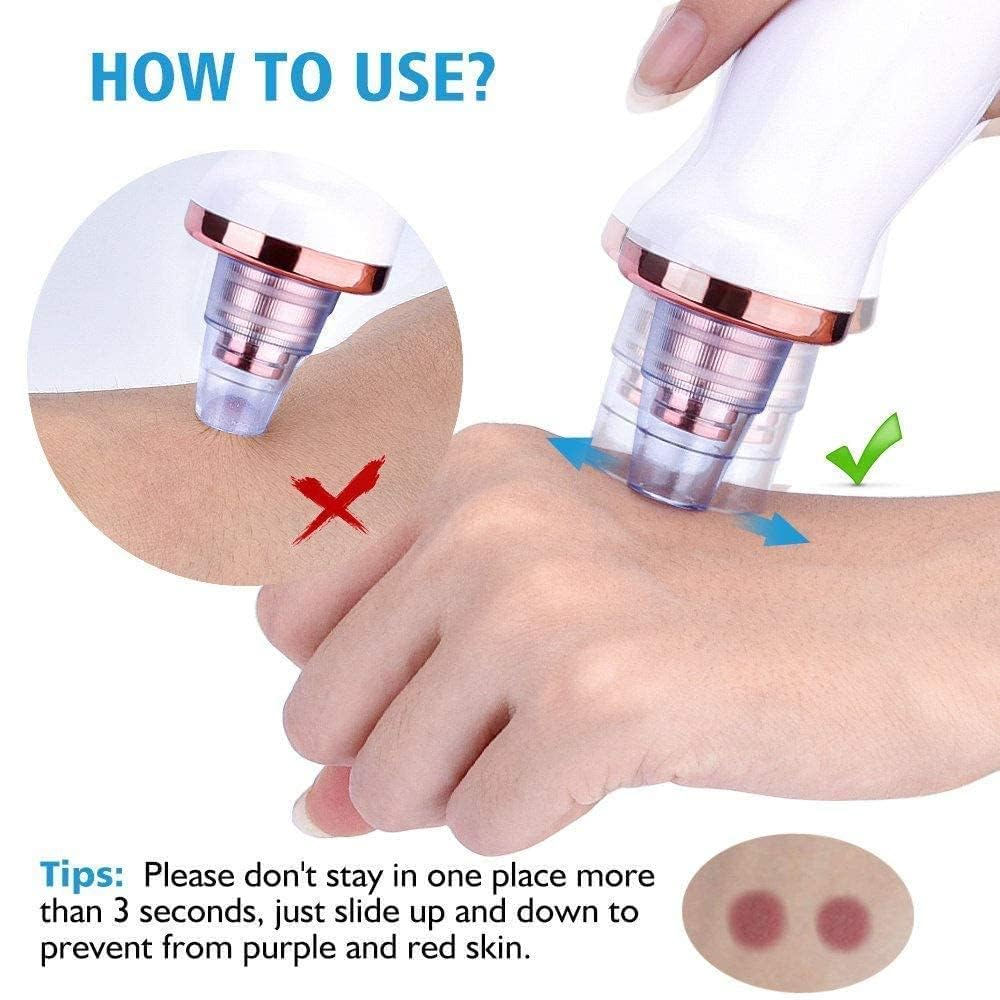 6-in-1 Blackhead Remover Vacuum – Electric Pore Cleaner with 3 Suction Levels | USB Rechargeable Acne & Deep Skin Care Tool