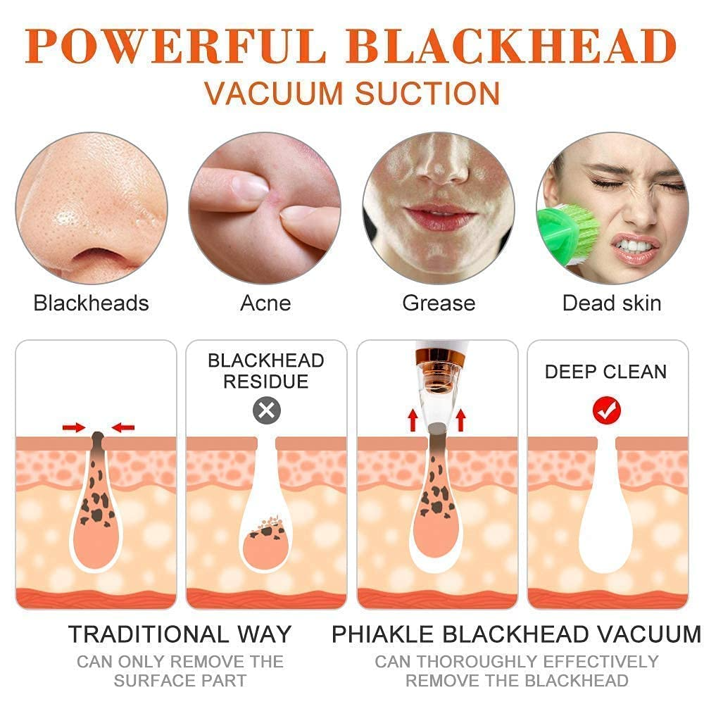 6-in-1 Blackhead Remover Vacuum – Electric Pore Cleaner with 3 Suction Levels | USB Rechargeable Acne & Deep Skin Care Tool