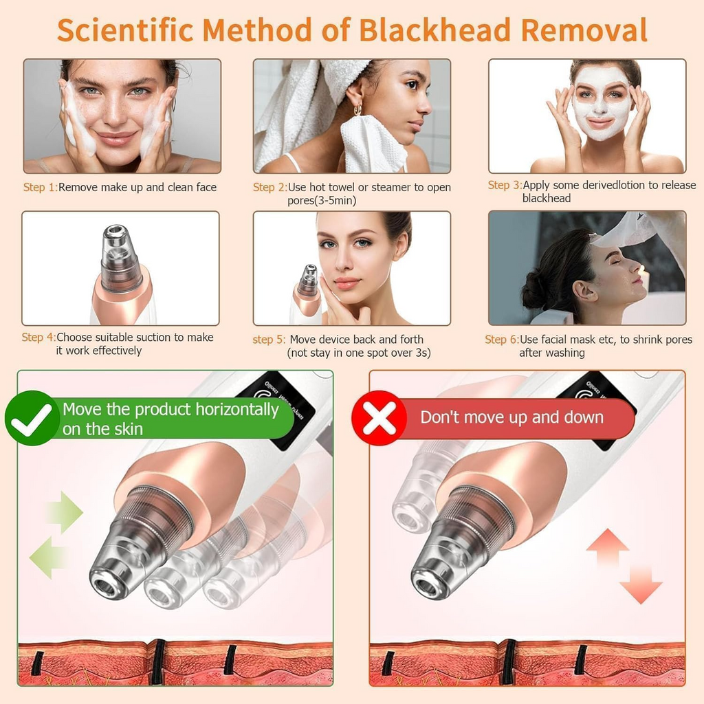 6-in-1 Blackhead Remover Vacuum – Electric Pore Cleaner with 3 Suction Levels | USB Rechargeable Acne & Deep Skin Care Tool